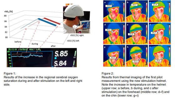 810nm Near Infrared Led Light Photobiomodulation Helmet For Brain Treatment