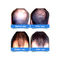 Class II 5mW Diode Laser Hair Growth Caps For Hair Loss