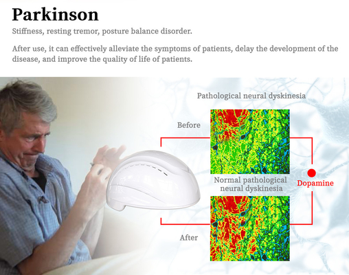 Touch Screen Control Photobiomodulation Helmet 810nm LED Near Infrared Light
